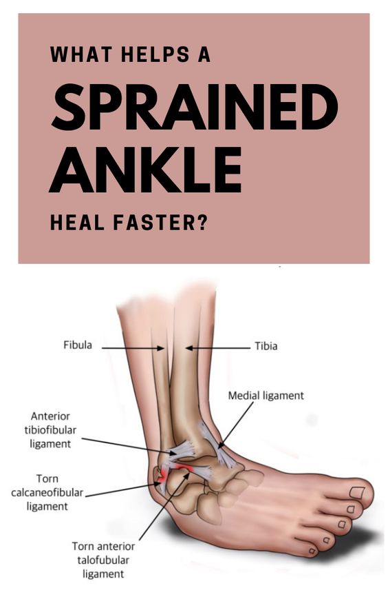 How Long Does Take For A Sprained Ankle To Heal saintjohn