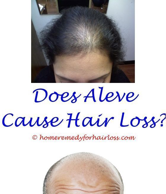 Bald Spot Cover Up Products marcabarcelona