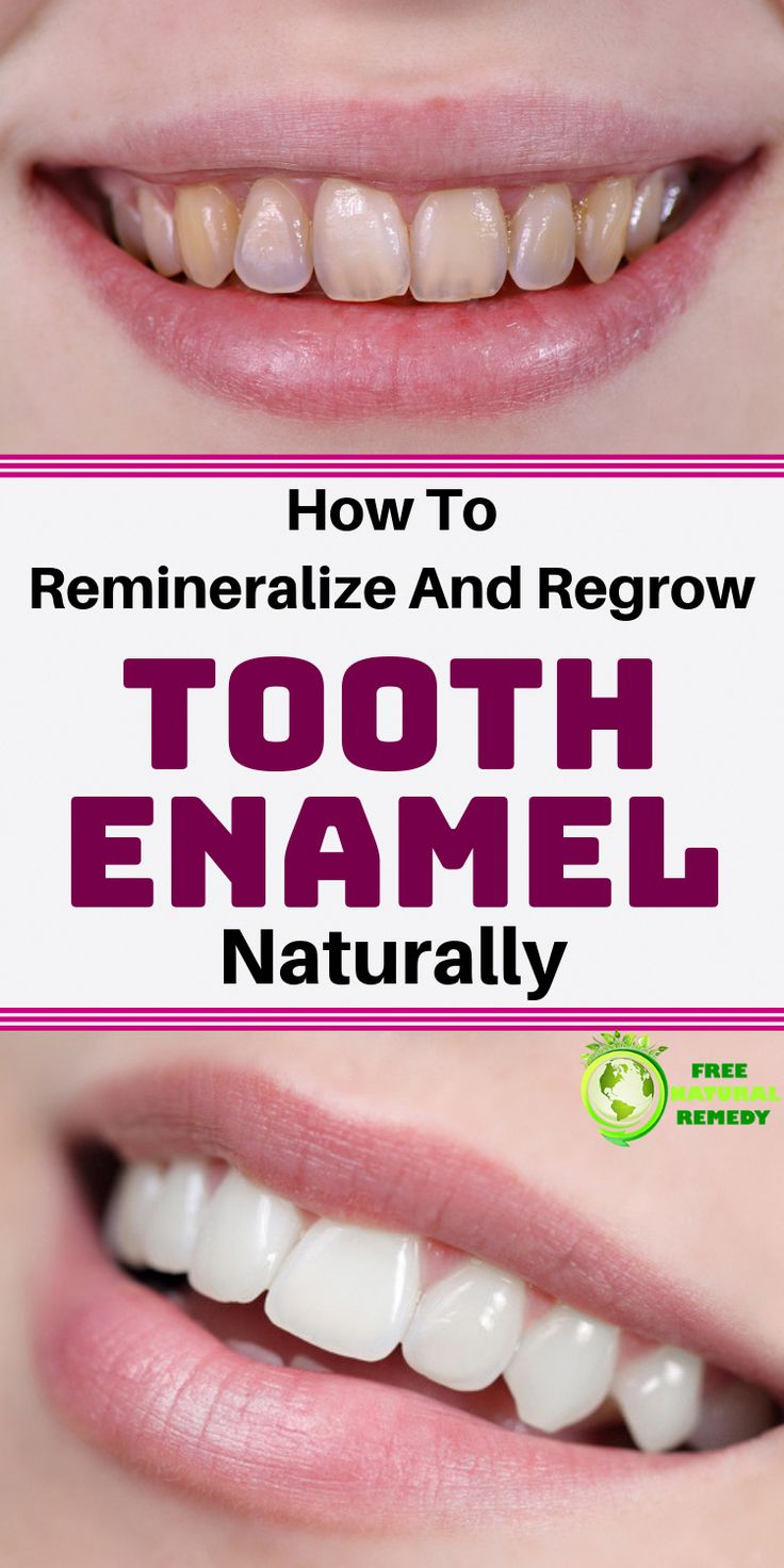 How To Remineralize Teeth Naturally 2021
