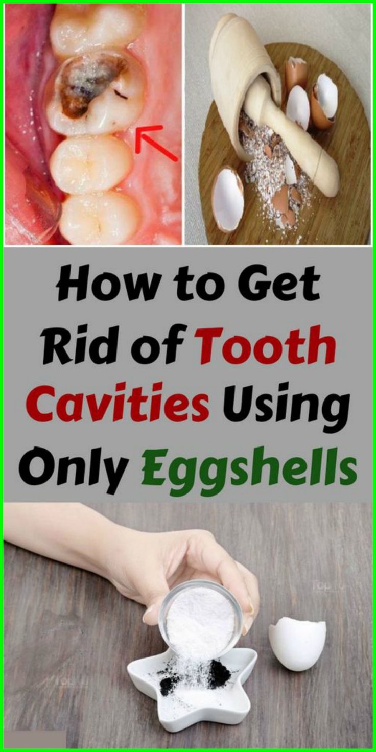 How to Get Rid of Tooth Cavities Using Only Eggshells