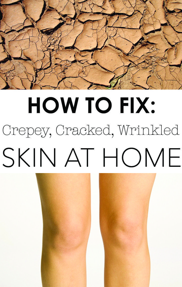 Beverly Hills surgeon explains at home fix for crepe skin