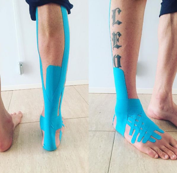Kinesio tape shin splints instructions