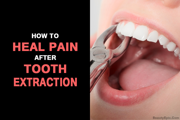 How Long Does A Tooth Extraction Take To Heal at Craigslist