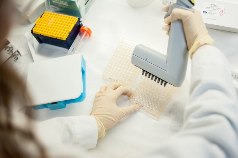 Labonachip COVID19 antibody test could offer rapid
