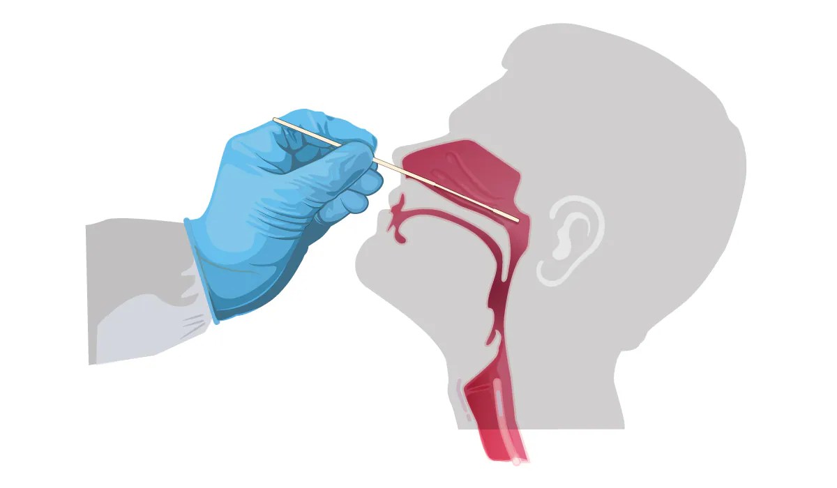 Interim Guidelines for Clinical Specimens for COVID19 CDC
