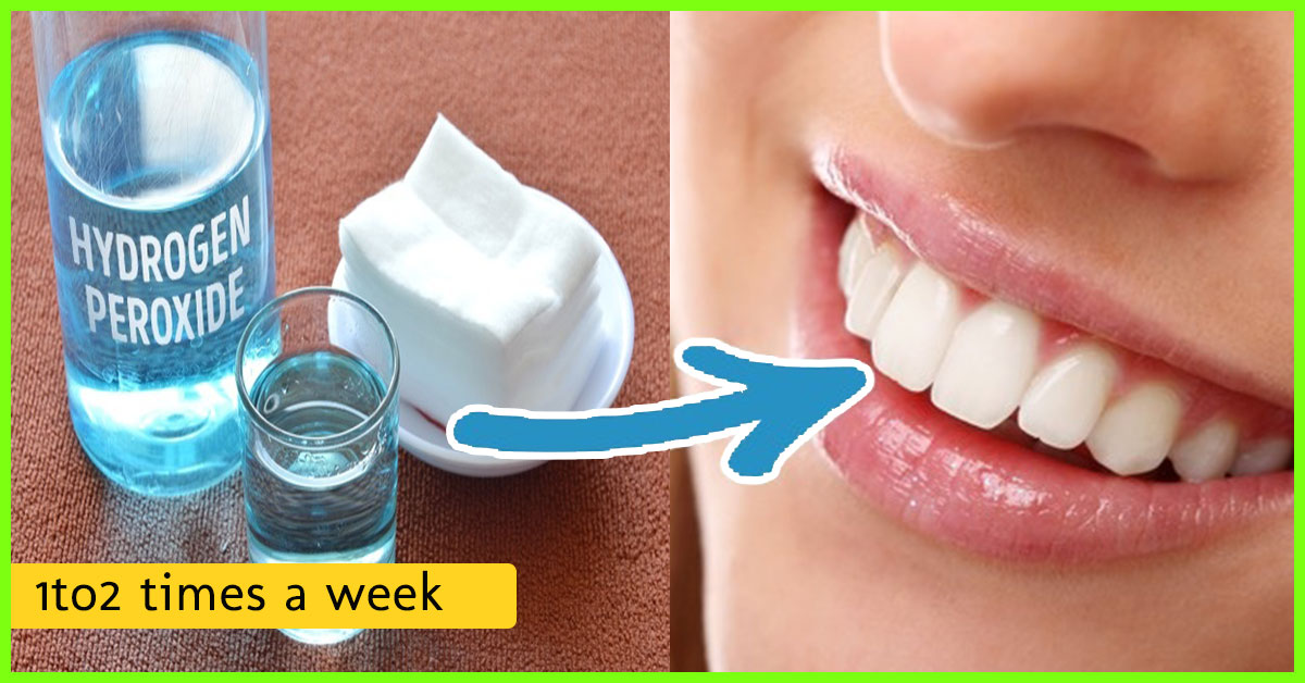 Hydrogen Peroxide For Teeth Whitening 6 Home Remedies To