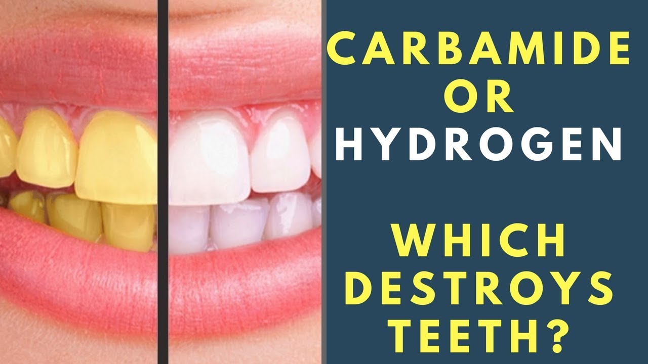 Carbamide Peroxide vs Hydrogen Peroxide Whitening Which