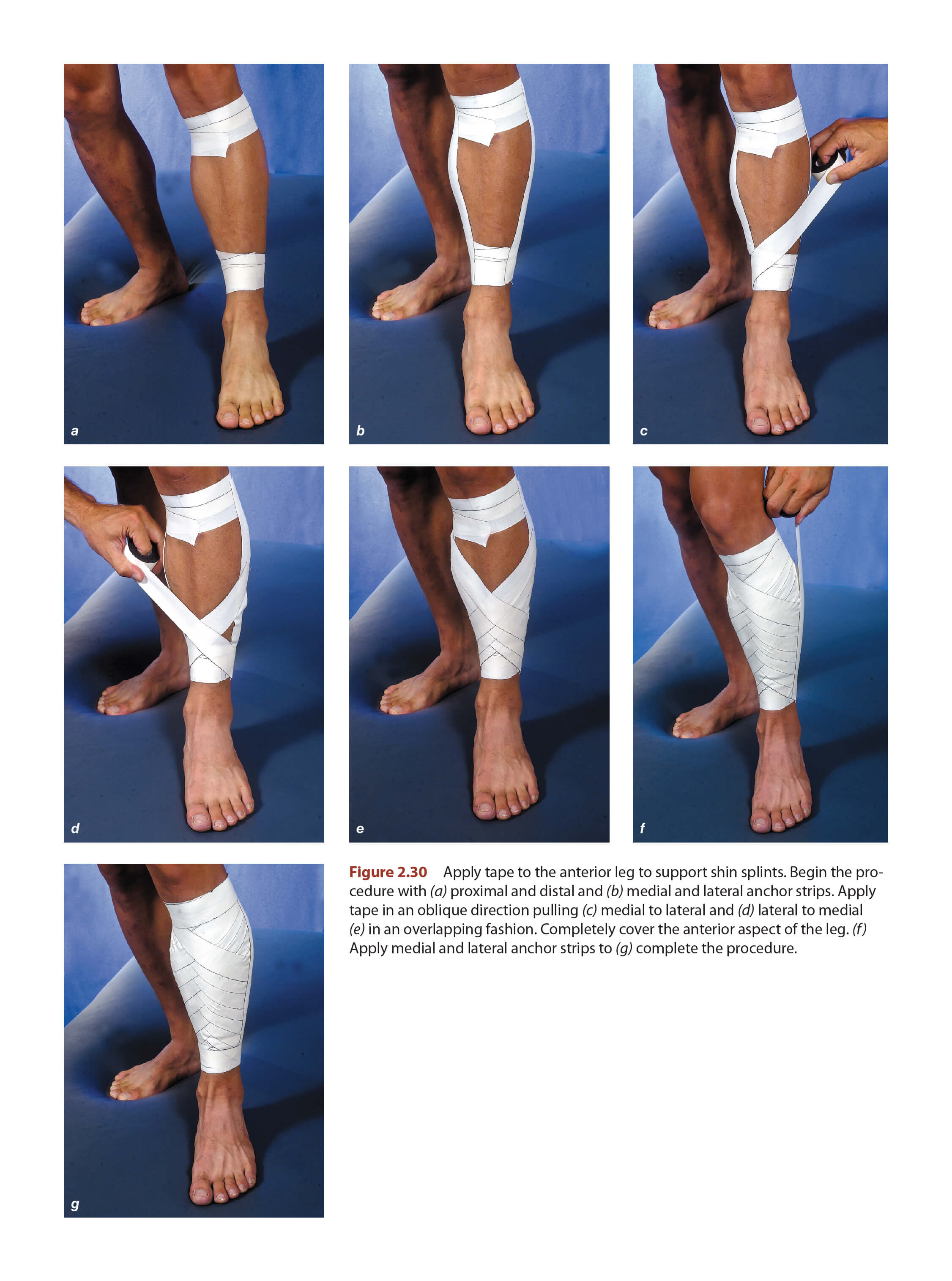 Shin Splints Taping Techniques Human Blog