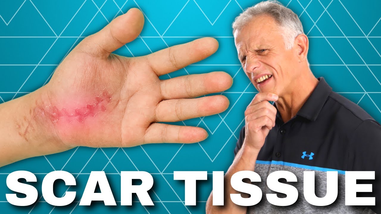 How To Break Up Scar Tissue After Arthroscopic Knee Surgery