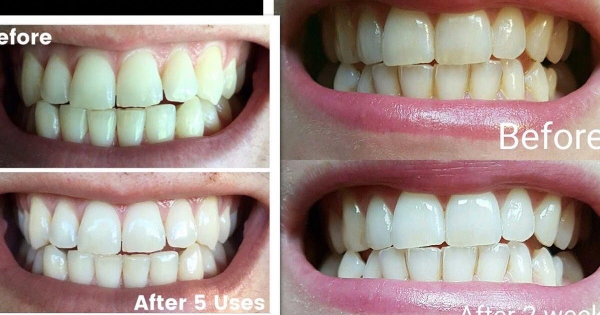 How To Clean Tongue After Red Wine taxpractitionerkerala