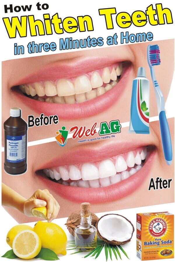 How to Whiten Teeth with Baking Soda and Hydrogen Peroxide