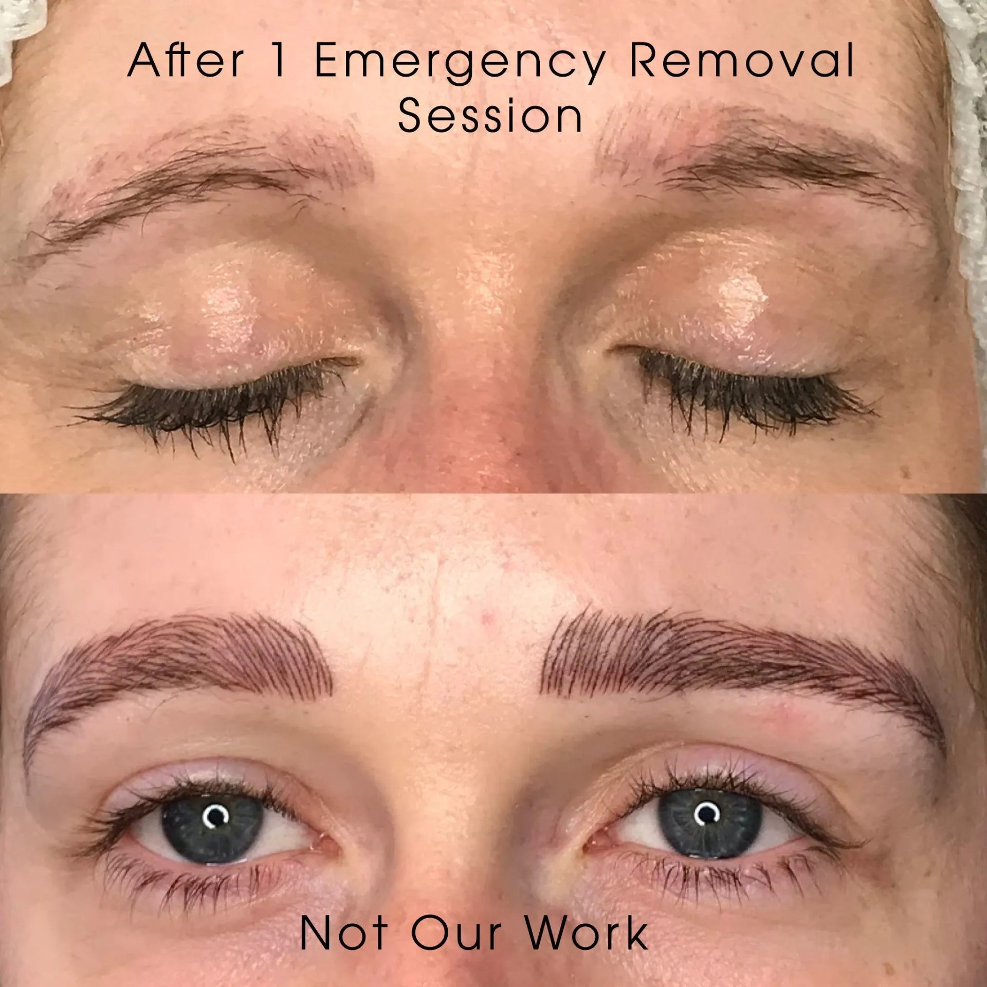 Permanent Makeup Removal Dana Depta Permanent Makeup