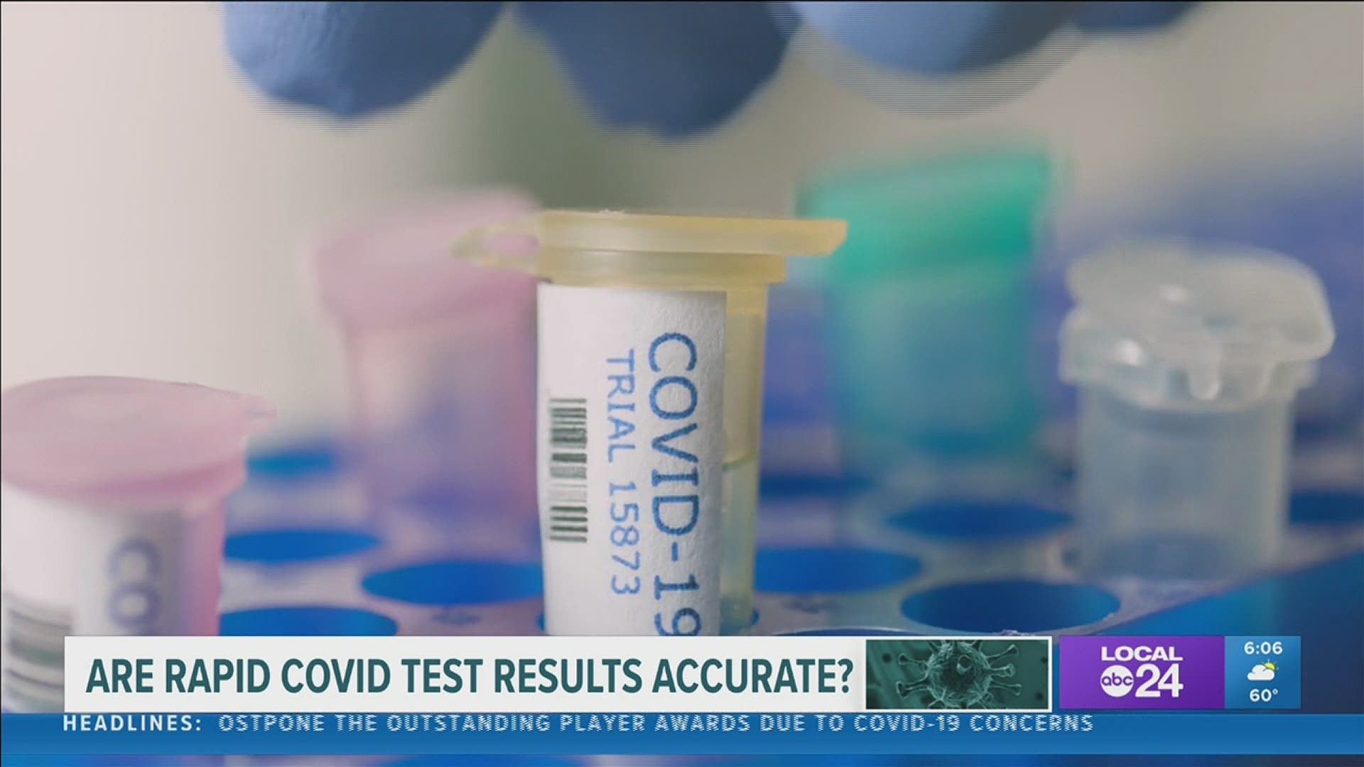 Rapid Results Covid Testing Near Me Columbus Ohio SULTRO