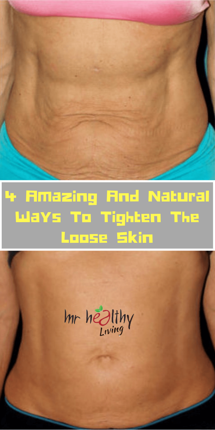 Best way to tighten skin,