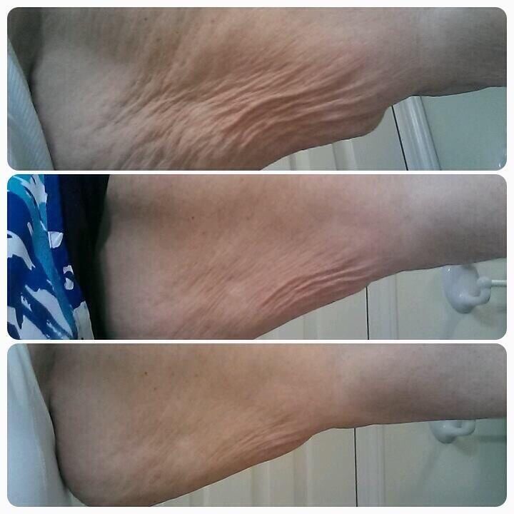Pin on Skin Tightening Tips