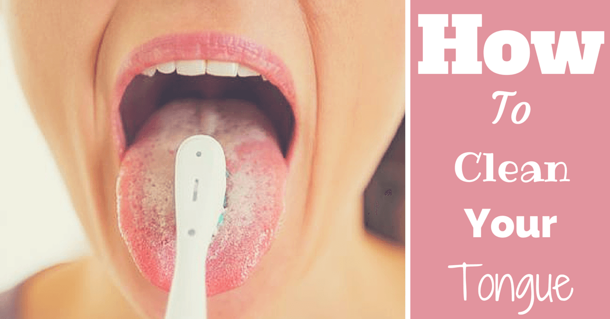 Pin on Dental Tips and Tricks!
