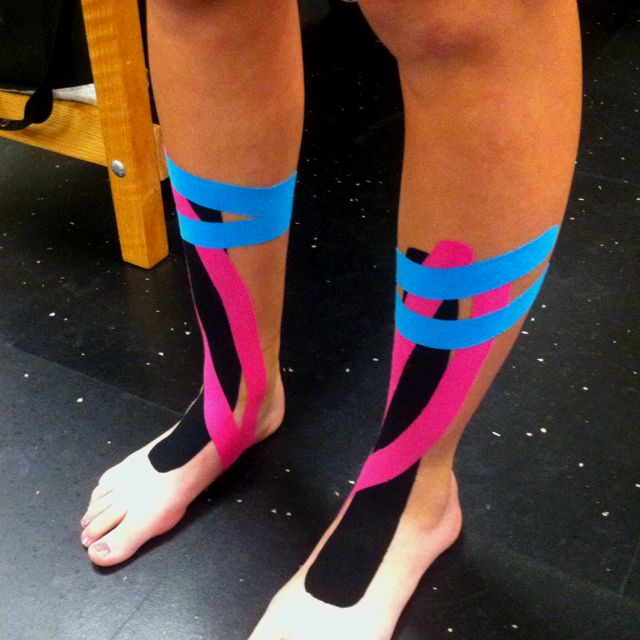 Kinesio Taping for Shin Splints Kinesio taping
