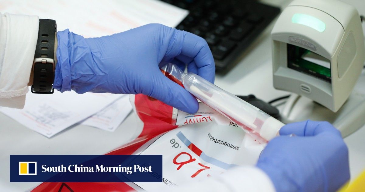 Coronavirus Testing Near Me Rapid CRONAVS