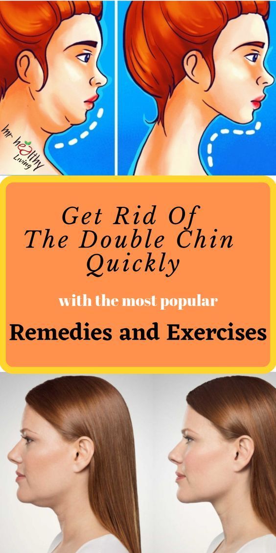 How to Get Rid of Turkey Neck Reduce double chin, Chin