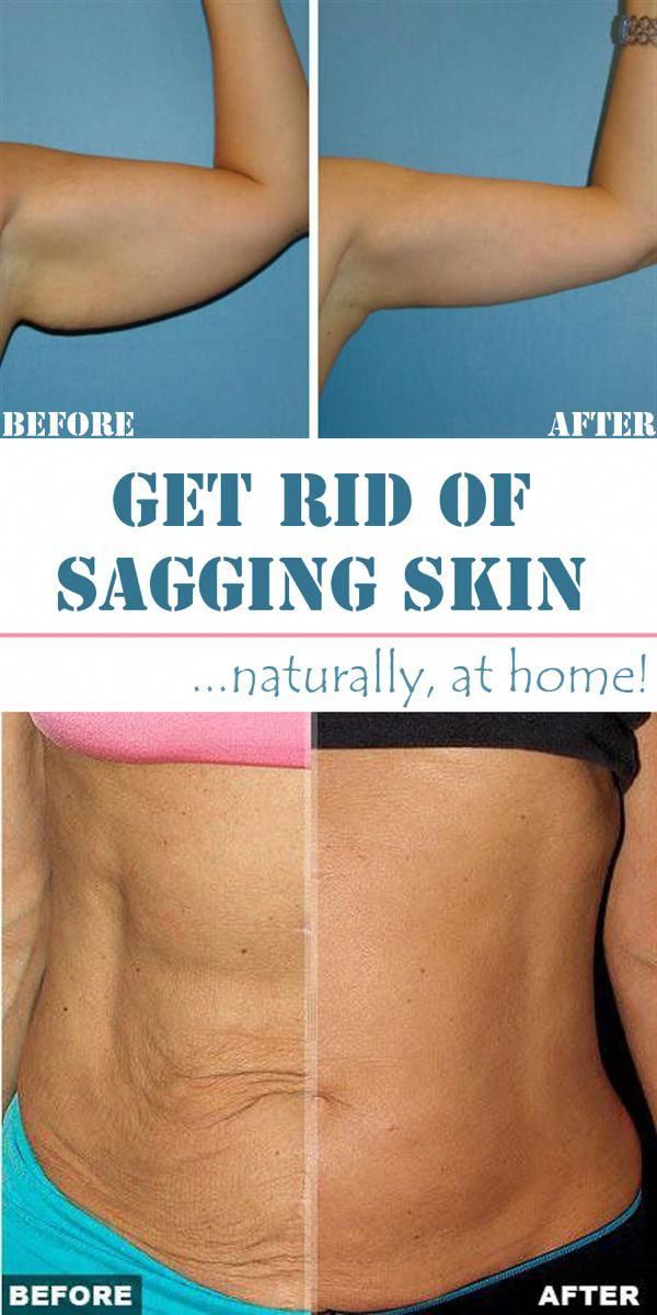 40 CREPEY Skin Home REMEDIES SaggyStomachSkinZara in 2020