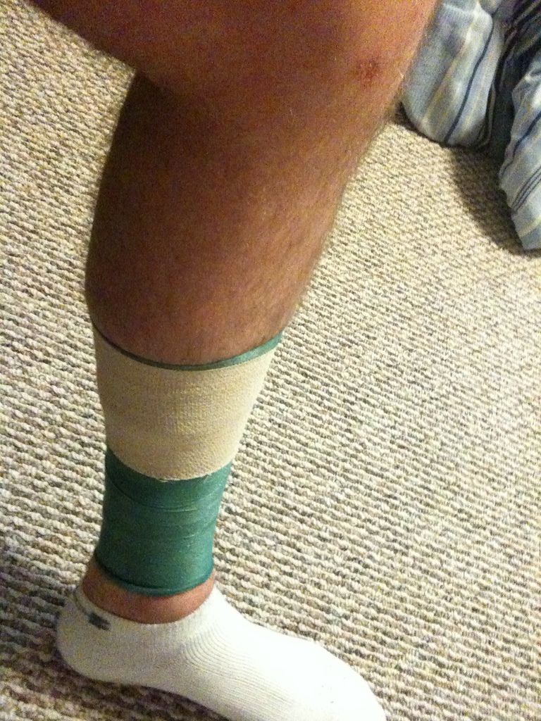 How to Tape Shin Splints Shin splints, Shin splint