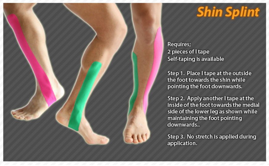 Kinesiology taping instructions for shint splints ktape 