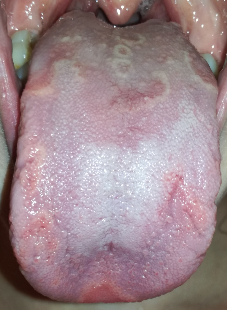 How To Clean Tongue After Red Wine / 2016 Steeple Street