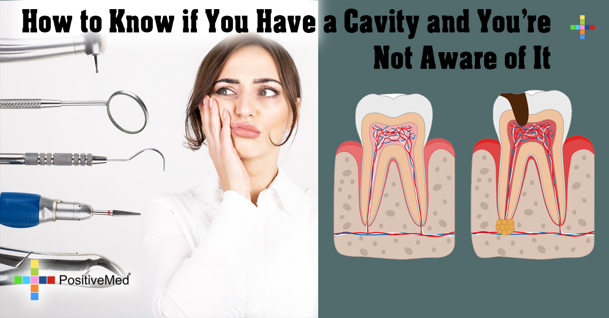 How To Tell If You Have A Cavity In Your Molar Wacote Party