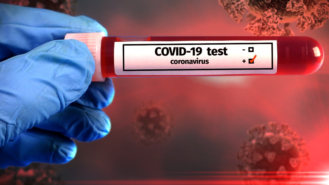 How accurate are at home COVID19 tests? An expert weighs in