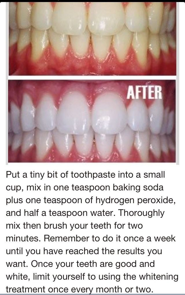 toothpaste, baking soda, hydrogen peroxide to whiten teeth