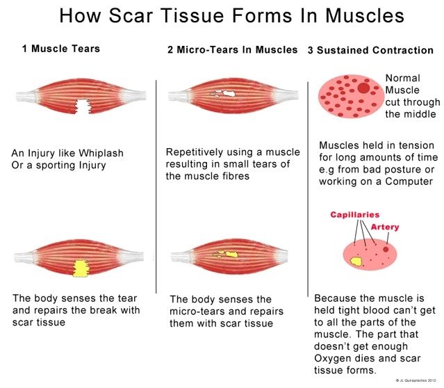 166 best images about Anatomy Tuesday on Pinterest Human