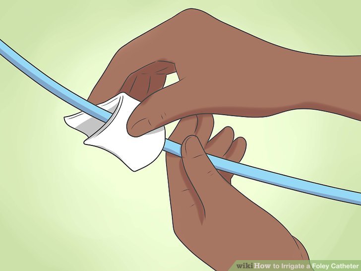 How to Irrigate a Foley Catheter (with Pictures) wikiHow